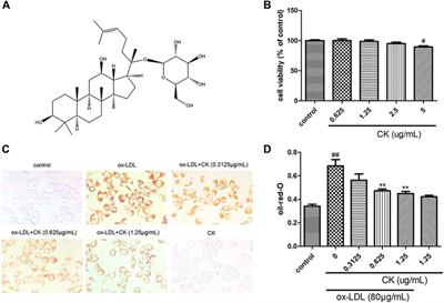 Corrigendum: Ginsenoside compound K attenuates ox-LDL-mediated macrophage inflammation and foam cell formation via autophagy induction and modulating NF-kB, p38, and JNK MAPK signaling